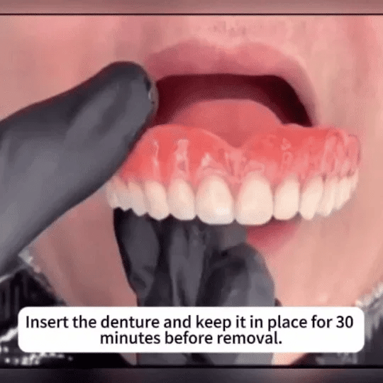 Medazy™ Custom-Fit Full Functional Dentures