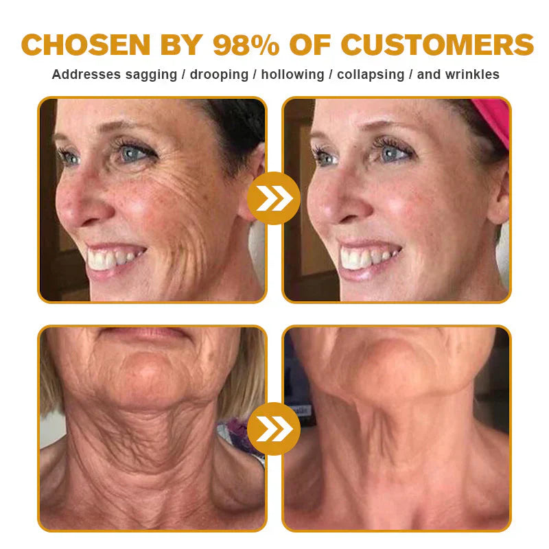 (š„LAST DAY SALE-70% OFF) LOVILDS⢠Botulin Bee Poison Wrinkle Removal Cream