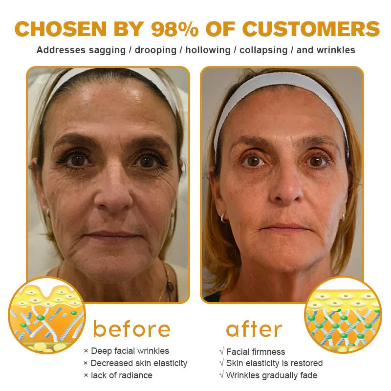 (š„LAST DAY SALE-70% OFF) LOVILDS⢠Botulin Bee Poison Wrinkle Removal Cream