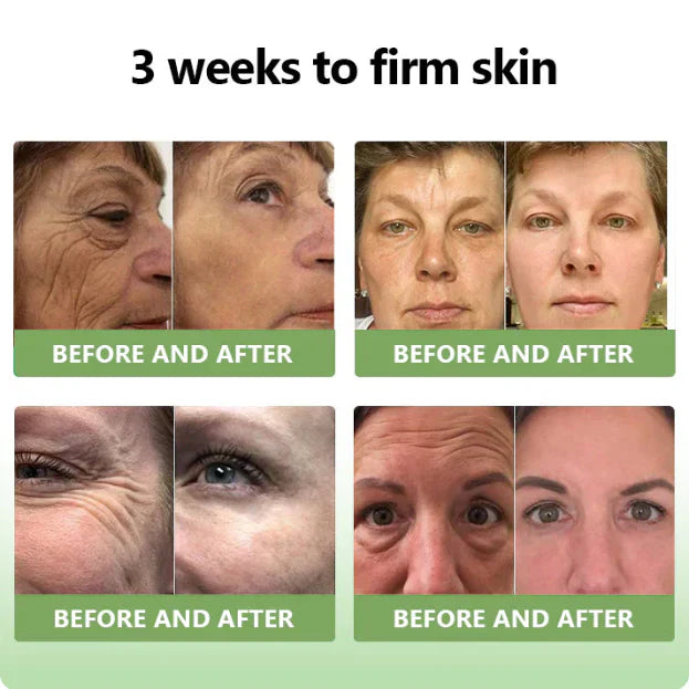 ✨️Advanced Formula 2.0🌿(🔥LAST DAY SALE-80% OFF) HZA™ Luxurious Collagen Firming Cream Pro