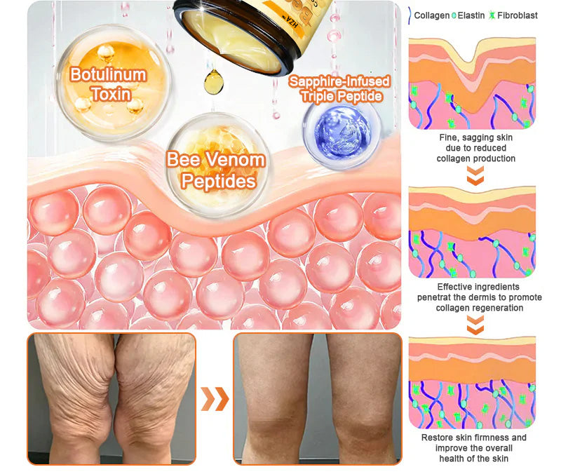 š„LAST DAY 80% OFF - HZA⢠Bee venom Comprehensive Cream