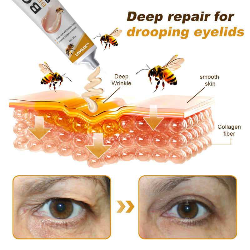 (š„LAST DAY SALE-70% OFF) LOVILDS⢠Botulin Bee Poison Wrinkle Removal Cream
