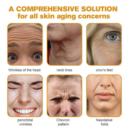 (🔥LAST DAY SALE-70% OFF) LOVILDS™ Botulin Bee Poison Wrinkle Removal Cream