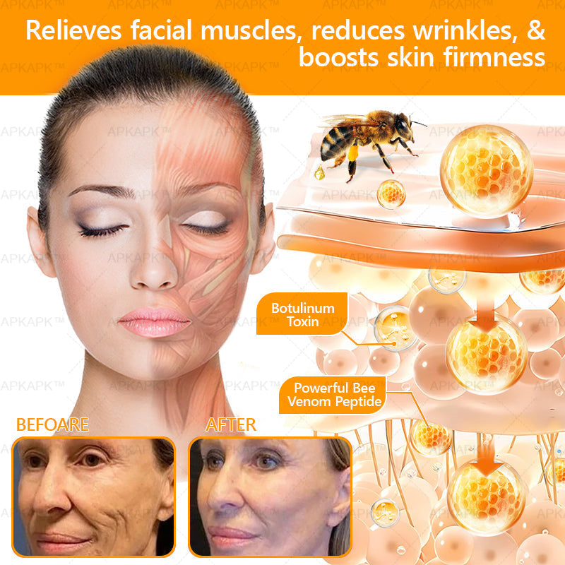 🔥LAST DAY 80% OFF  - HZA™ Bee venom Comprehensive Cream