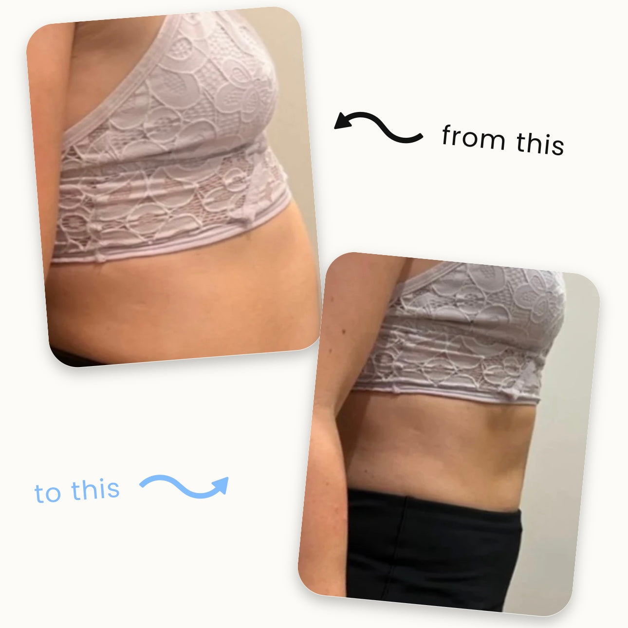 Qooes™Slimming Patches 🍏｜🔥 Fast Fat Burn & Metabolic Balance｜Backed by Obesity Research Experts