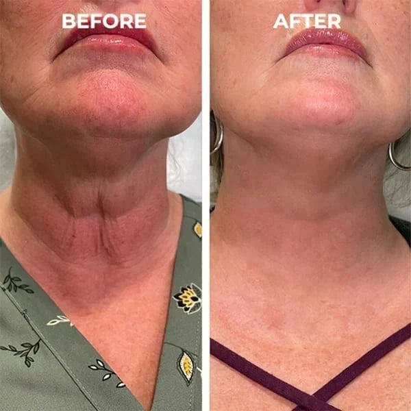 (🔥LAST DAY SALE-80% OFF) Insideefy™ Cordyceps Firming Repair Serum